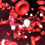 Anemia – a description of the disease